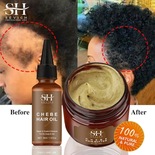 Sevich Chebe Hair Loss Treatment Spray Traction Alopecia Chebe Powder - Image 2
