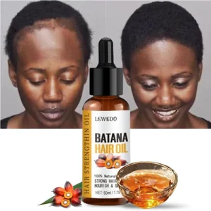 Lewedo Naturals Batana Oil Fast Hair Growth for Men Women Pure Batana