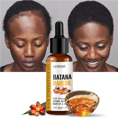 Lewedo Naturals Batana Oil Fast Hair Growth for Men Women Pure Batana